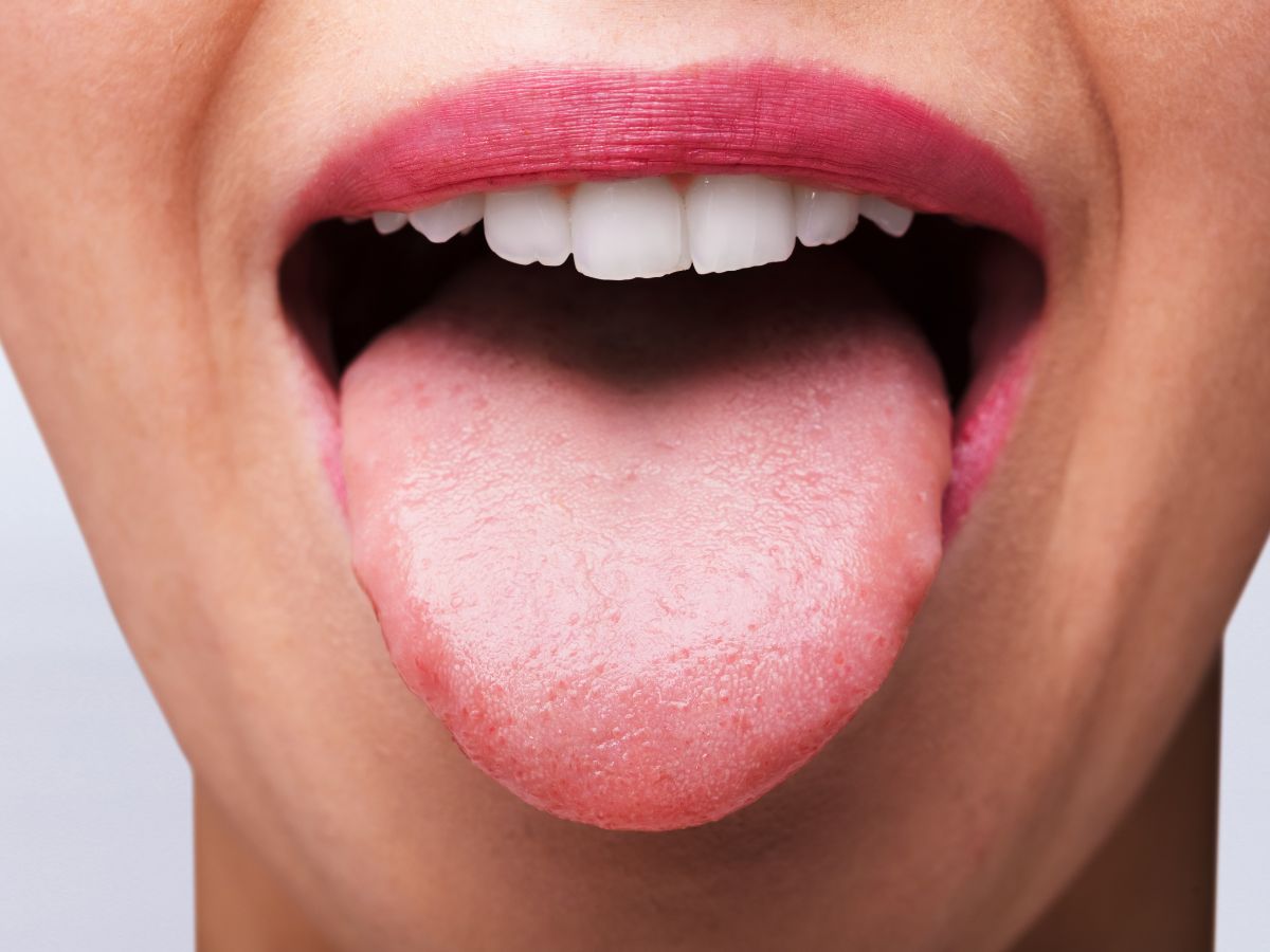 How To Clean The Tongue Properly At Home In 5 Steps Flipboard 